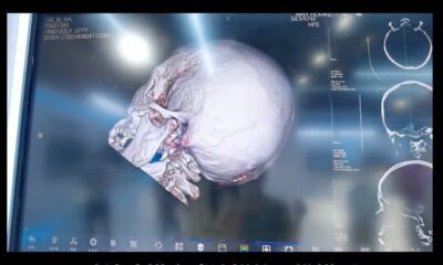 medical imaging system