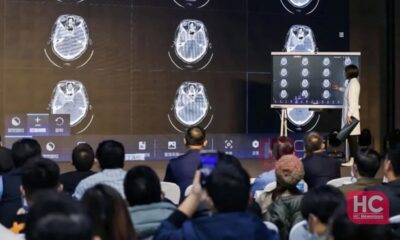 Huawei medical imaging system